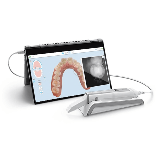 Digital impressions for custom oral appliances