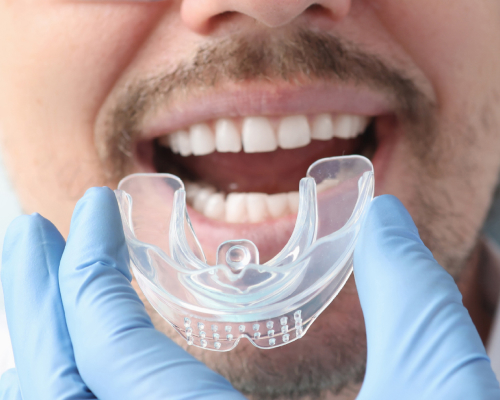 oral appliance fabrication