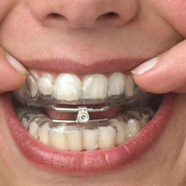 Oral Appliance Therapy