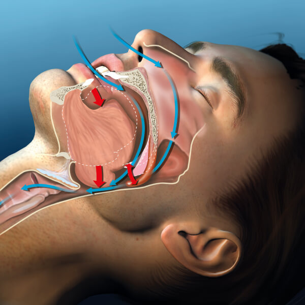 sleep apnea specialists in Kansas
