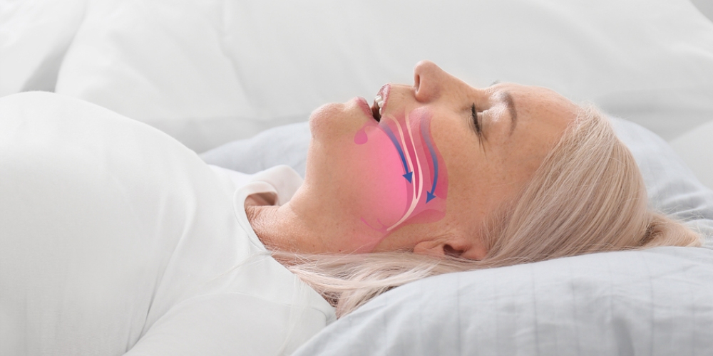 The Hidden Dangers of Untreated Sleep Apnea
